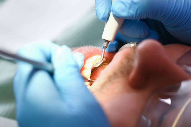Best Emergency Denture Repair in Pinch, WV
