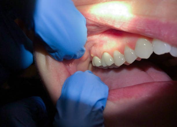 Best Weekend Emergency Dental Services in Pinch, WV