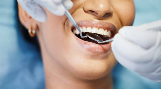 Best Knocked-Out Tooth (Avulsed Tooth) Treatment in Pinch, WV