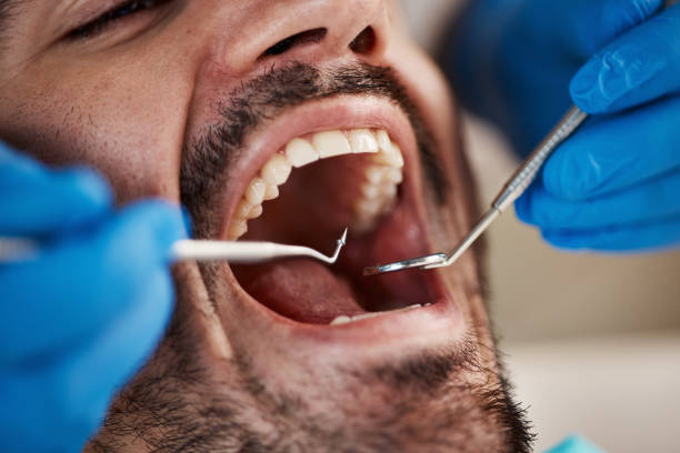 Best Emergency Treatment for Oral Infections in Pinch, WV